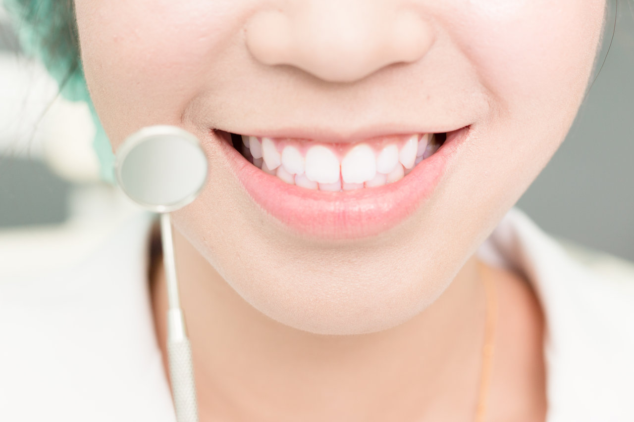 Crowns, Veneers and Bridges dental clinic